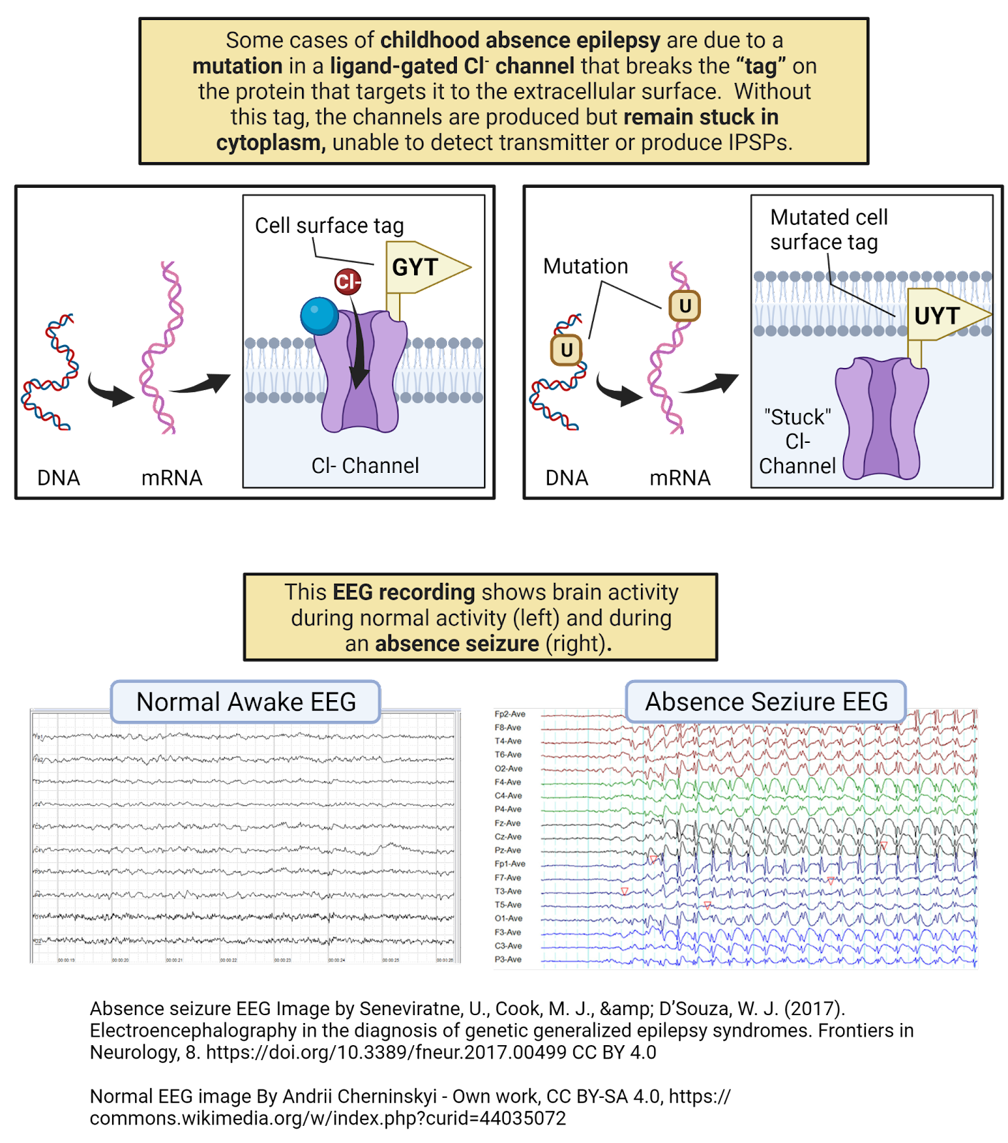 Childhood absence epilepsy and mutations in ligand-gated $Cl^{-}$ channels.